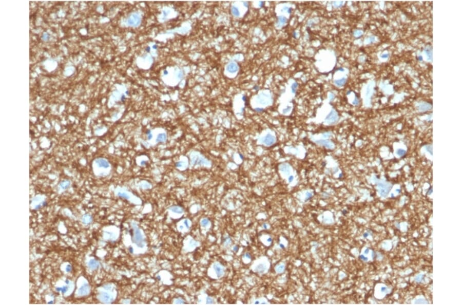 Immunohistochemistry - Anti-p14ARF Antibody [4C6/4] (A248103) - Antibodies.com