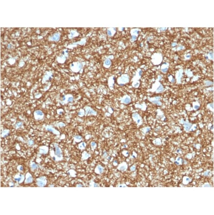 Immunohistochemistry - Anti-p14ARF Antibody [4C6/4] (A248103) - Antibodies.com
