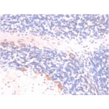 Immunohistochemistry - Anti-p14ARF Antibody [4C6/4] (A248104) - Antibodies.com
