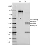 SDS-PAGE - Anti-p14ARF Antibody [4C6/4] (A248104) - Antibodies.com