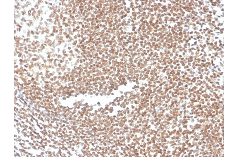 Immunohistochemistry - Anti-p16INK4a Antibody [CDKN2A/3830] (A248105) - Antibodies.com