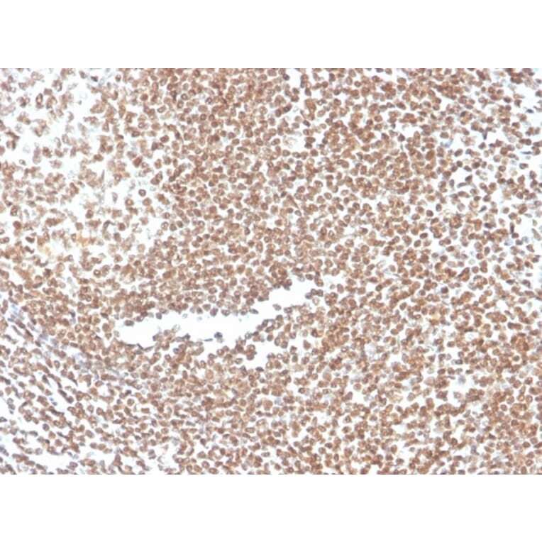 Immunohistochemistry - Anti-p16INK4a Antibody [CDKN2A/3830] (A248105) - Antibodies.com