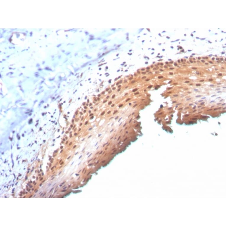 Immunohistochemistry - Anti-p16INK4a Antibody [CDKN2A/3830] (A248104) - Antibodies.com