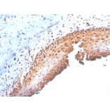 Immunohistochemistry - Anti-p16INK4a Antibody [CDKN2A/3830] (A248104) - Antibodies.com