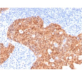 Immunohistochemistry - Anti-p16INK4a Antibody [CDKN2A/4499] (A248106) - Antibodies.com