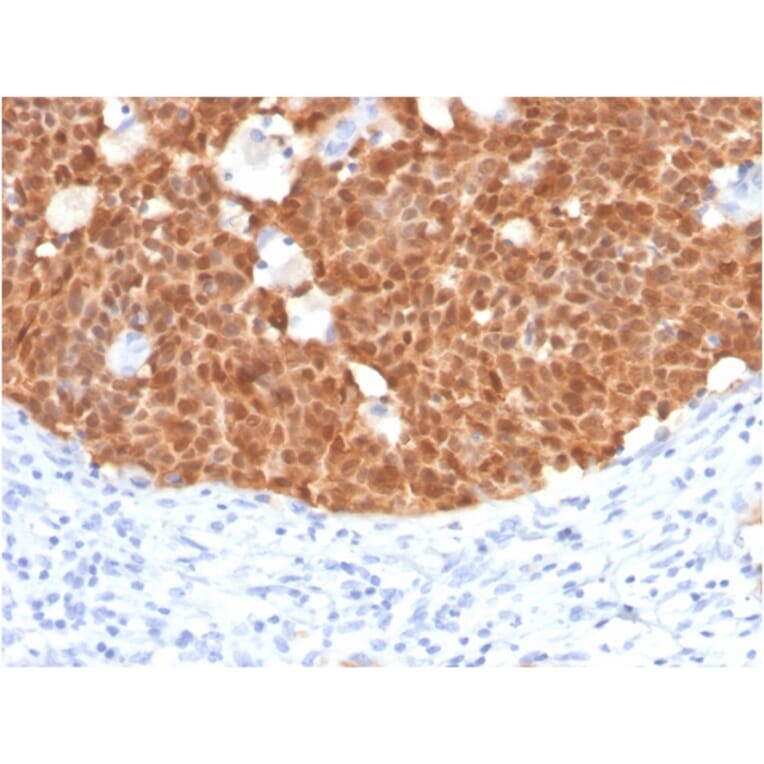 Immunohistochemistry - Anti-p16INK4a Antibody [CDKN2A/4499] (A248105) - Antibodies.com
