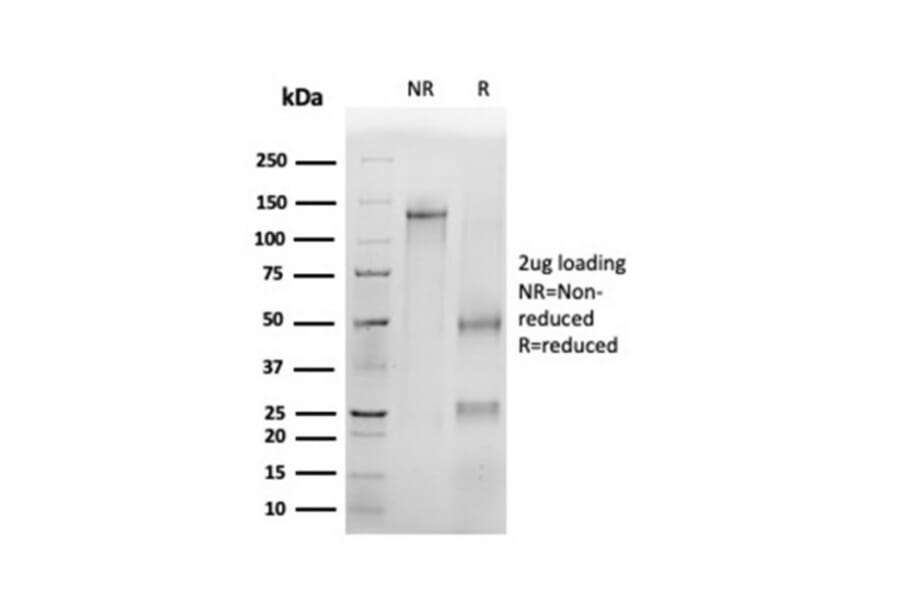 SDS-PAGE - Anti-p16INK4a Antibody [CDKN2A/4499] (A248106) - Antibodies.com