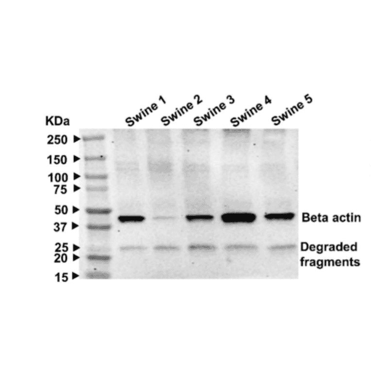 Western Blot - Anti-beta III Tubulin antibody - Antibodies.com