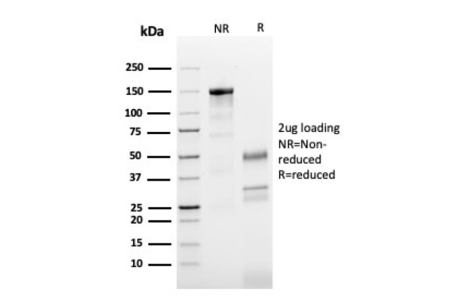 SDS-PAGE - Anti-beta III Tubulin Antibody [TUBB3/3731] (A248107) - Antibodies.com