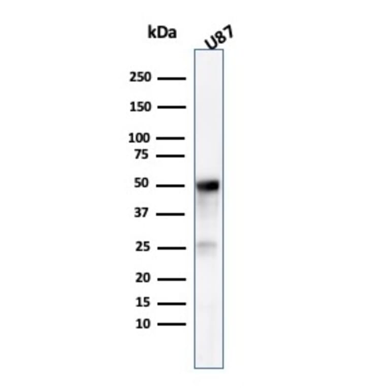 Western Blot - Anti-beta III Tubulin Antibody [TUBB3/3731] (A248107) - Antibodies.com