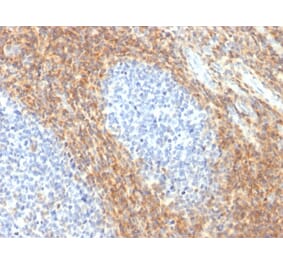 Immunohistochemistry - Anti-CD52 Antibody [CD52/2276R] (A248109) - Antibodies.com