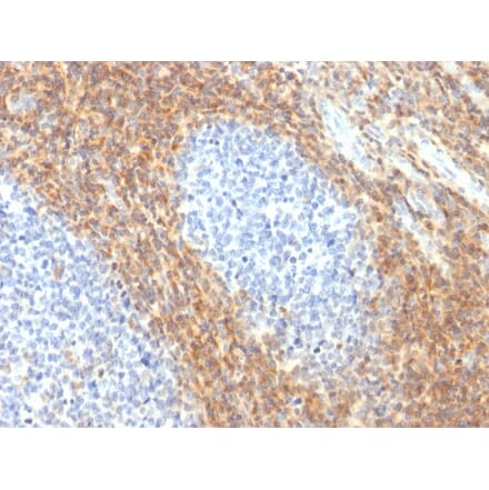 Immunohistochemistry - Anti-CD52 Antibody [CD52/2276R] (A248109) - Antibodies.com