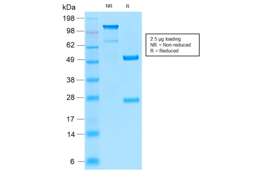 Immunohistochemistry - Anti-CD52 Antibody [CD52/2276R] (A248108) - Antibodies.com