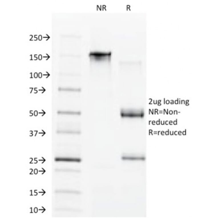 SDS-PAGE - Anti-CDX1 Antibody [CDX1/1650] (A248109) - Antibodies.com