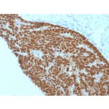 Immunohistochemistry - Anti-CDX2 Antibody [CDX2/1690] (A248111) - Antibodies.com