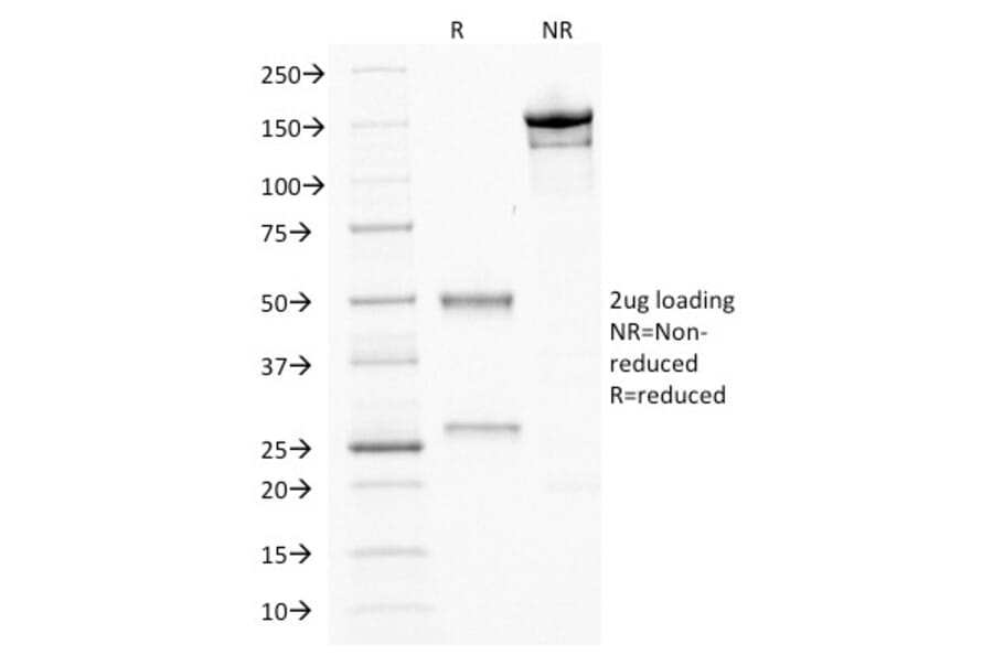 SDS-PAGE - Anti-CDX2 Antibody [CDX2/1690] (A248111) - Antibodies.com