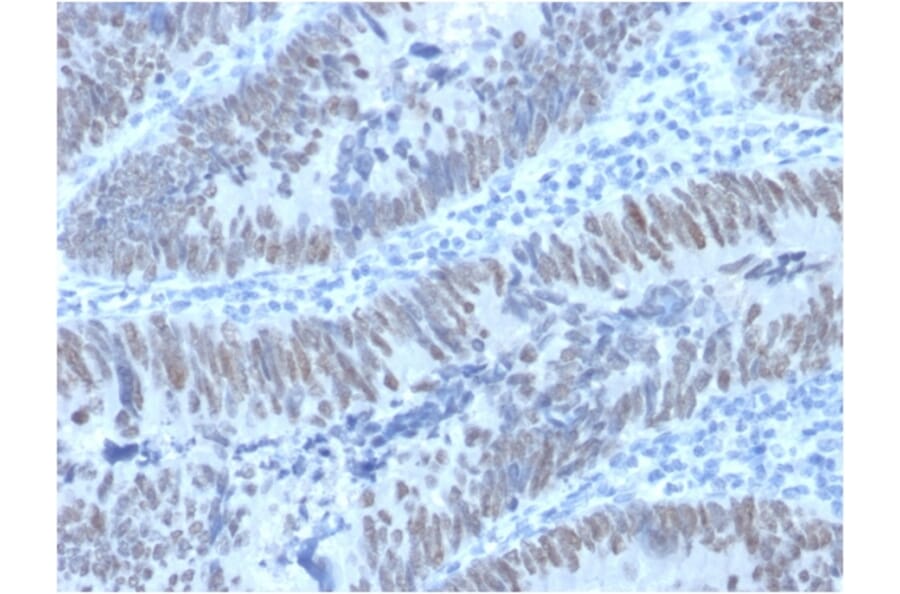 Immunohistochemistry - Anti-CDX2 Antibody [PCRP-CDX2-1A3] (A248112) - Antibodies.com