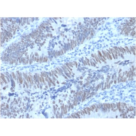 Immunohistochemistry - Anti-CDX2 Antibody [PCRP-CDX2-1A3] (A248112) - Antibodies.com