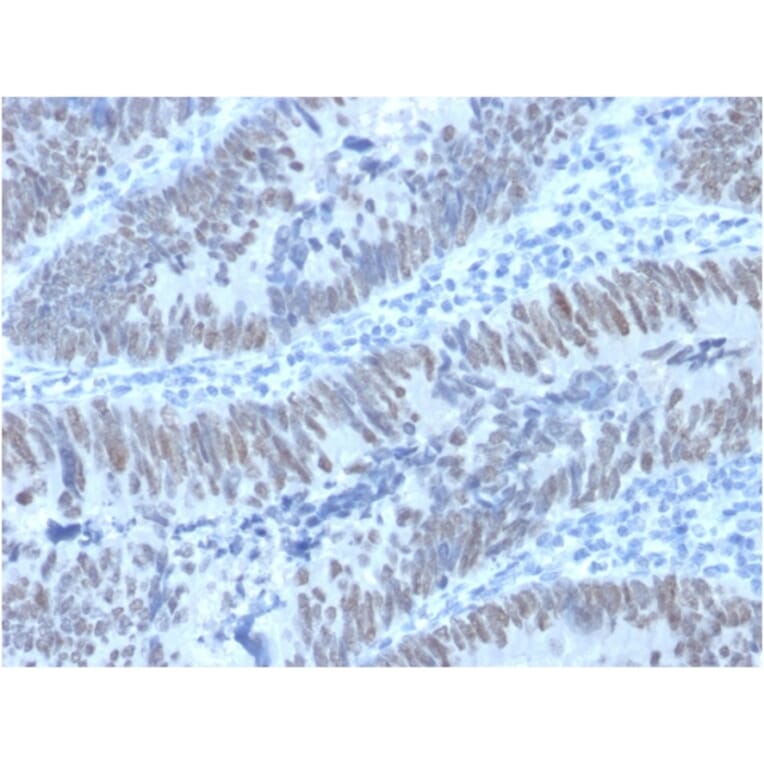 Immunohistochemistry - Anti-CDX2 Antibody [PCRP-CDX2-1A3] (A248112) - Antibodies.com