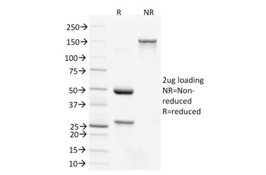 SDS-PAGE - Anti-CDX2 Antibody [PCRP-CDX2-1A3] (A248112) - Antibodies.com