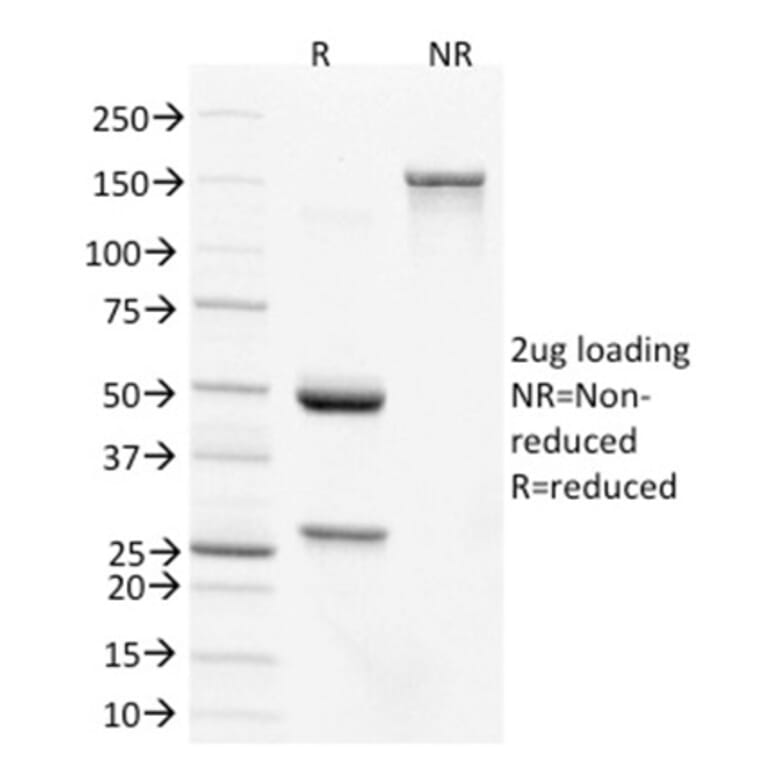 SDS-PAGE - Anti-CDX2 Antibody [PCRP-CDX2-1A3] (A248112) - Antibodies.com