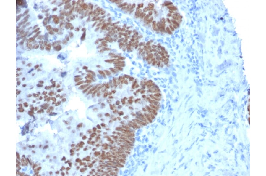 Immunohistochemistry - Anti-CDX2 Antibody [CDX2/2214] (A248113) - Antibodies.com