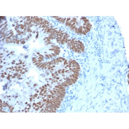 Immunohistochemistry - Anti-CDX2 Antibody [CDX2/2214] (A248113) - Antibodies.com