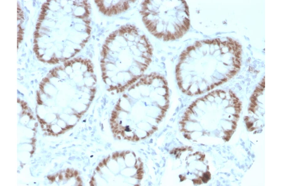 Immunohistochemistry - Anti-CDX2 Antibody [rCDX2/1690] (A248114) - Antibodies.com