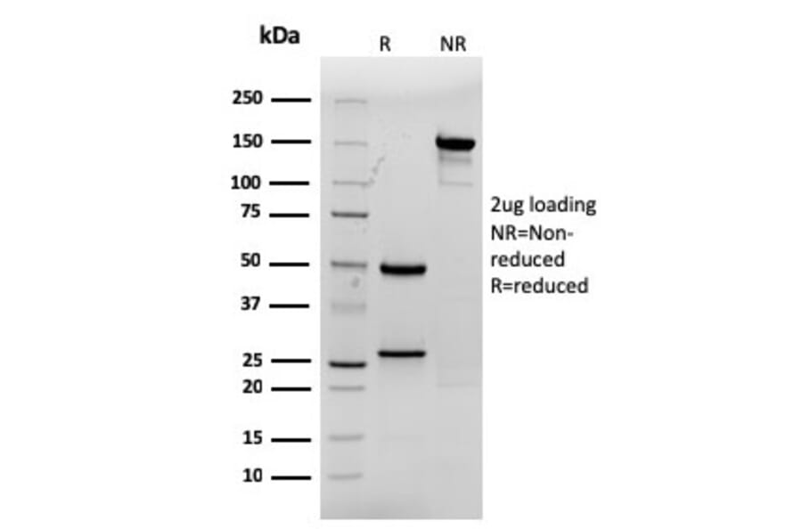 SDS-PAGE - Anti-CDX2 Antibody [rCDX2/1690] (A248114) - Antibodies.com