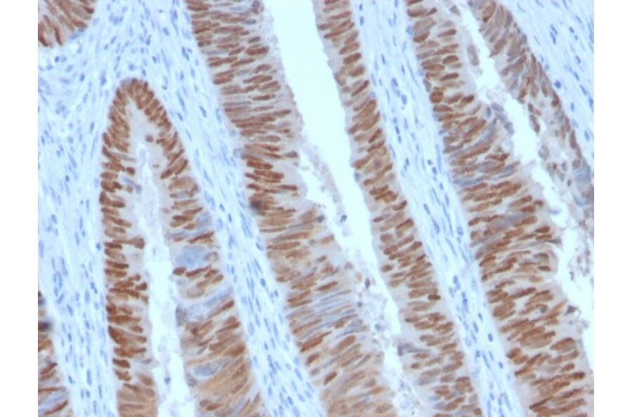 Immunohistochemistry - Anti-CDX2 Antibody [CDX2/2951R] (A248115) - Antibodies.com