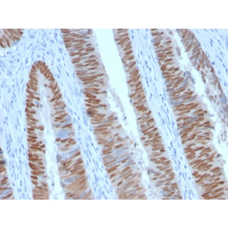 Immunohistochemistry - Anti-CDX2 Antibody [CDX2/2951R] (A248115) - Antibodies.com