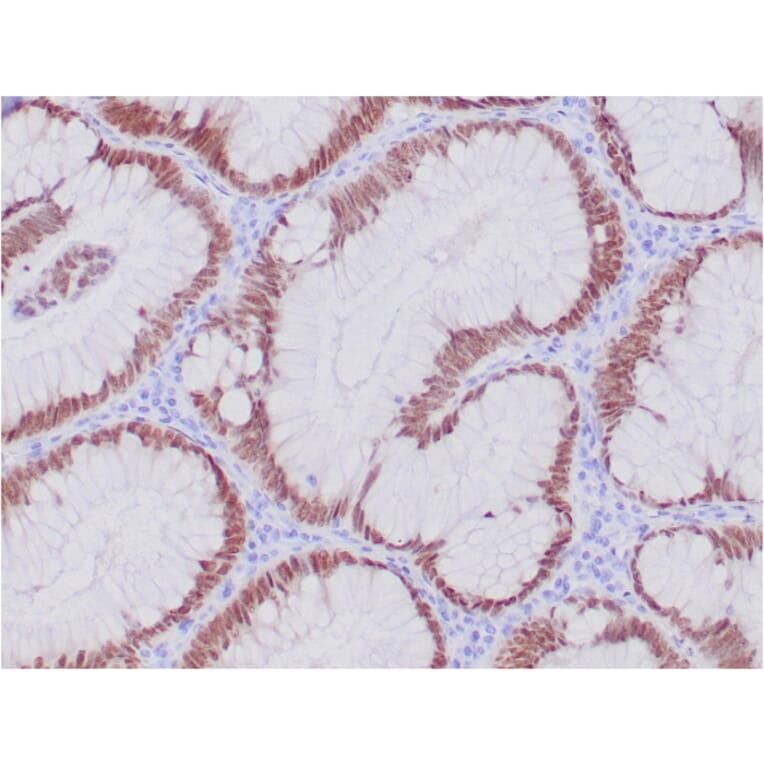 Immunohistochemistry - Anti-CDX2 Antibody [CDX2/4394R] (A248115) - Antibodies.com