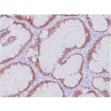 Immunohistochemistry - Anti-CDX2 Antibody [CDX2/4394R] (A248115) - Antibodies.com