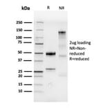 SDS-PAGE - Anti-CDX2 Antibody [CDX2/4394R] (A248116) - Antibodies.com
