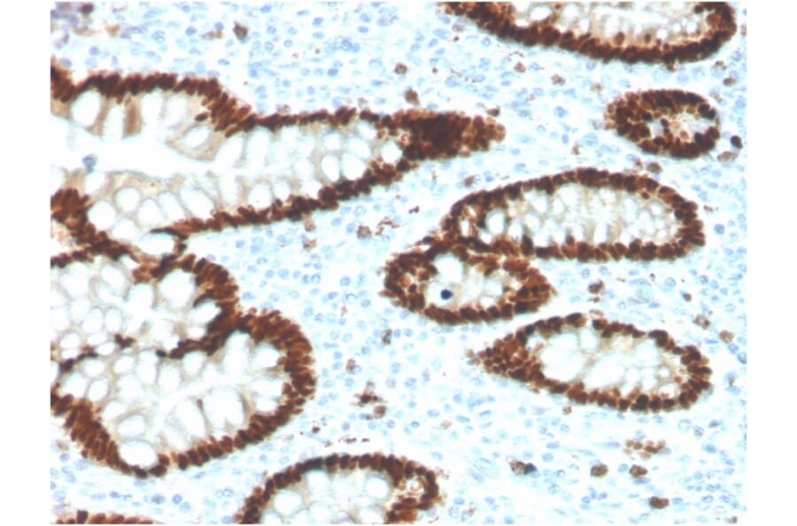 Immunohistochemistry - Anti-CDX2 Antibody [CDX2/4394R] (A248116) - Antibodies.com