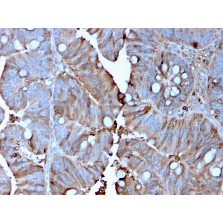 Immunohistochemistry - Anti-MerTK Antibody [MERTK/3015] (A248117) - Antibodies.com