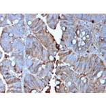 Immunohistochemistry - Anti-MerTK Antibody [MERTK/3015] (A248117) - Antibodies.com