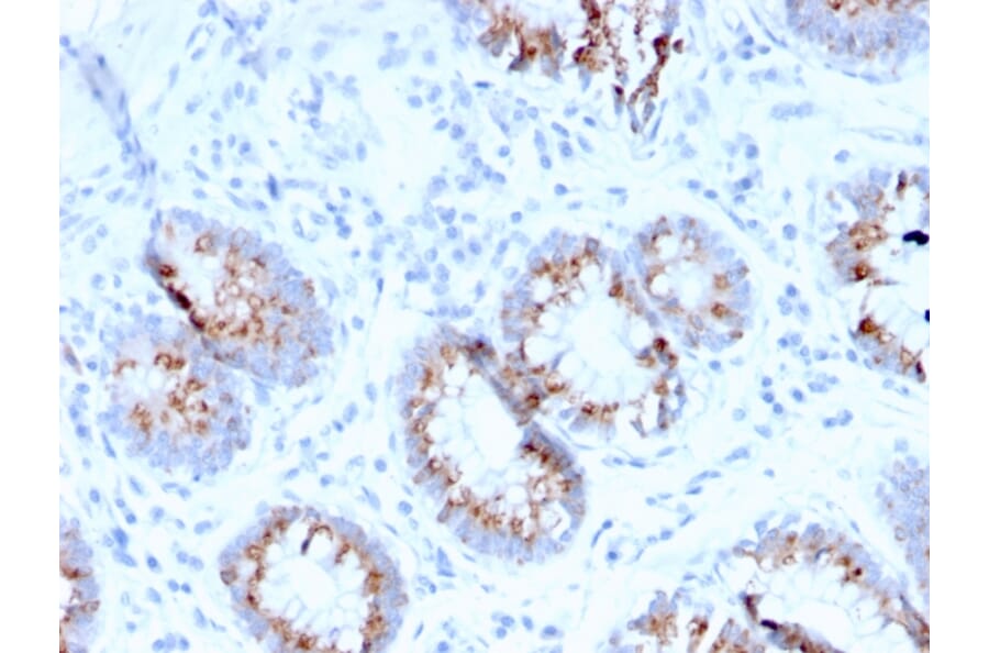 Immunohistochemistry - Anti-MerTK Antibody [MERTK/3015] (A248117) - Antibodies.com