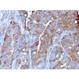 Immunohistochemistry - Anti-MerTK Antibody [MERTK/3022] (A248118) - Antibodies.com