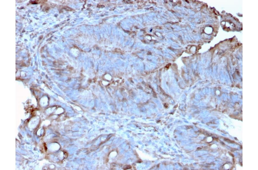 Immunohistochemistry - Anti-MerTK Antibody [MERTK/3022] (A248118) - Antibodies.com