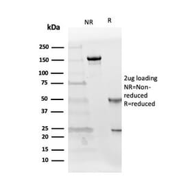 SDS-PAGE - Anti-Follistatin Antibody [FST/4281] (A248119) - Antibodies.com