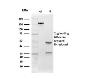 SDS-PAGE - Anti-Follistatin Antibody [FST/4282] (A248119) - Antibodies.com