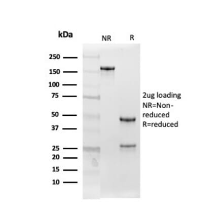 SDS-PAGE - Anti-Follistatin Antibody [FST/4282] (A248119) - Antibodies.com