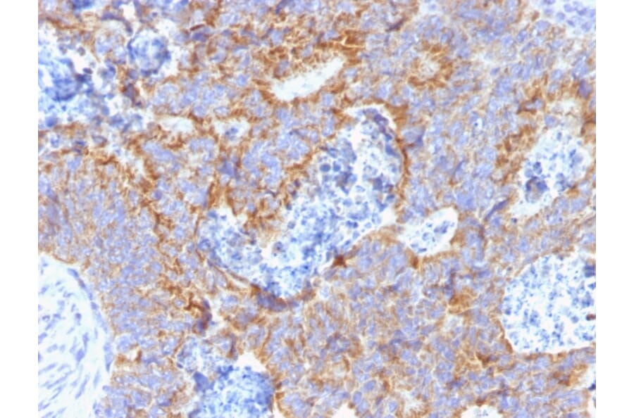 Immunohistochemistry - Anti-Carcinoembryonic Antigen Antibody [C66/1291] (A248122) - Antibodies.com