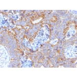 Immunohistochemistry - Anti-Carcinoembryonic Antigen Antibody [C66/1291] (A248122) - Antibodies.com