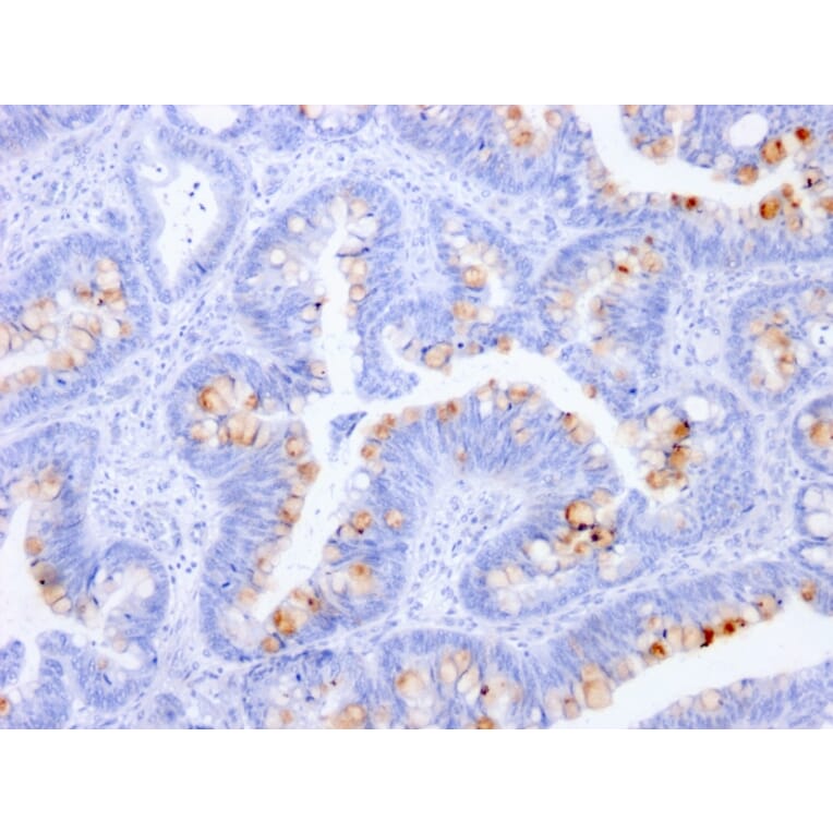 Immunohistochemistry - Anti-Carcinoembryonic Antigen Antibody [C66/1291] (A248121) - Antibodies.com