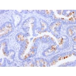 Immunohistochemistry - Anti-Carcinoembryonic Antigen Antibody [C66/1291] (A248121) - Antibodies.com