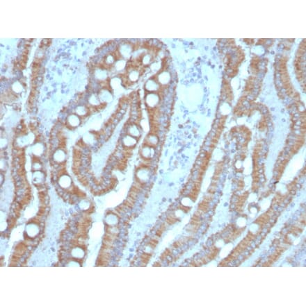 Immunohistochemistry - Anti-Carcinoembryonic Antigen Antibody [C66/4098] (A248125) - Antibodies.com