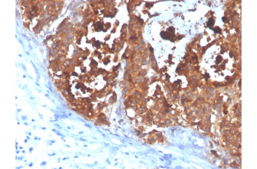 Immunohistochemistry - Anti-Carcinoembryonic Antigen Antibody [C66/4098] (A248125) - Antibodies.com