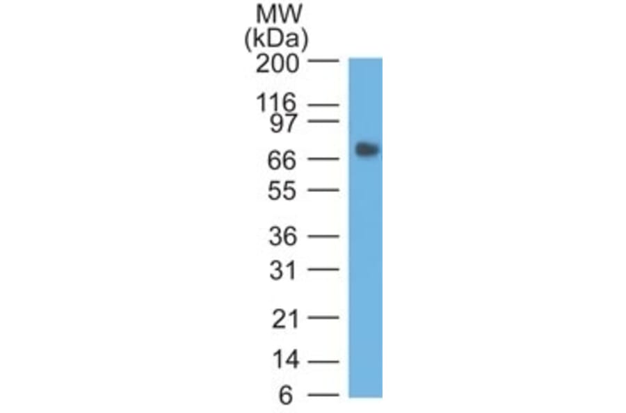 Western Blot - Anti-Carcinoembryonic Antigen Antibody [COL-1] (A248126) - Antibodies.com